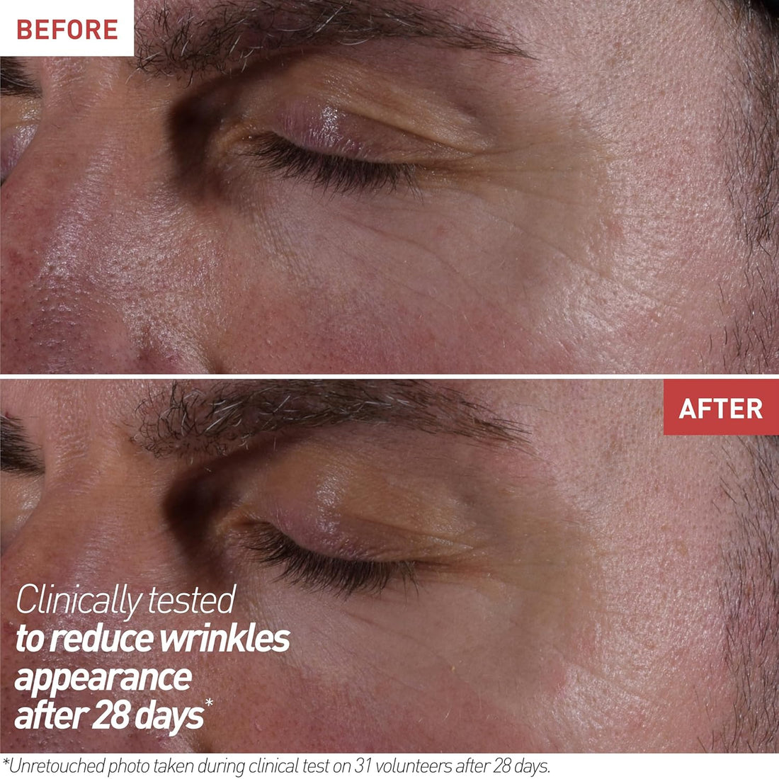 Erborian Skin Therapy Eye Cream 15 ml
